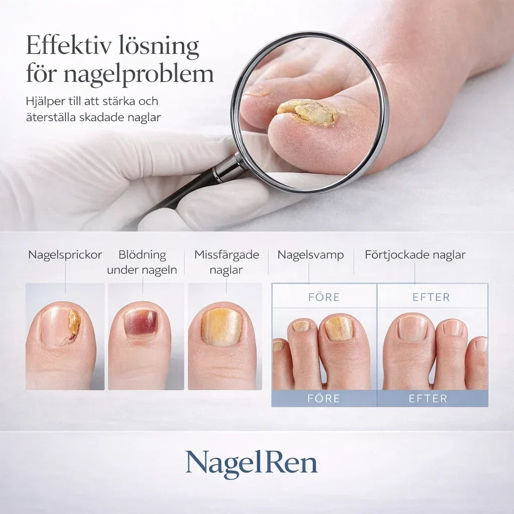 NagelRen – För friskare och klarare naglar hemma