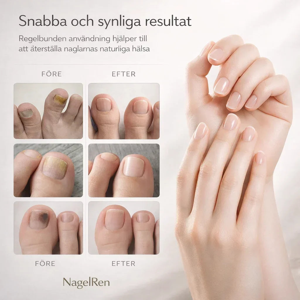NagelRen – För friskare och klarare naglar hemma