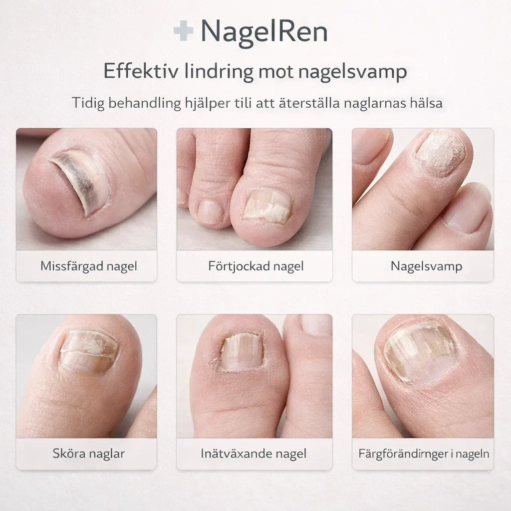 NagelRen – För friskare och klarare naglar hemma