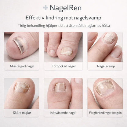 NagelRen – För friskare och klarare naglar hemma